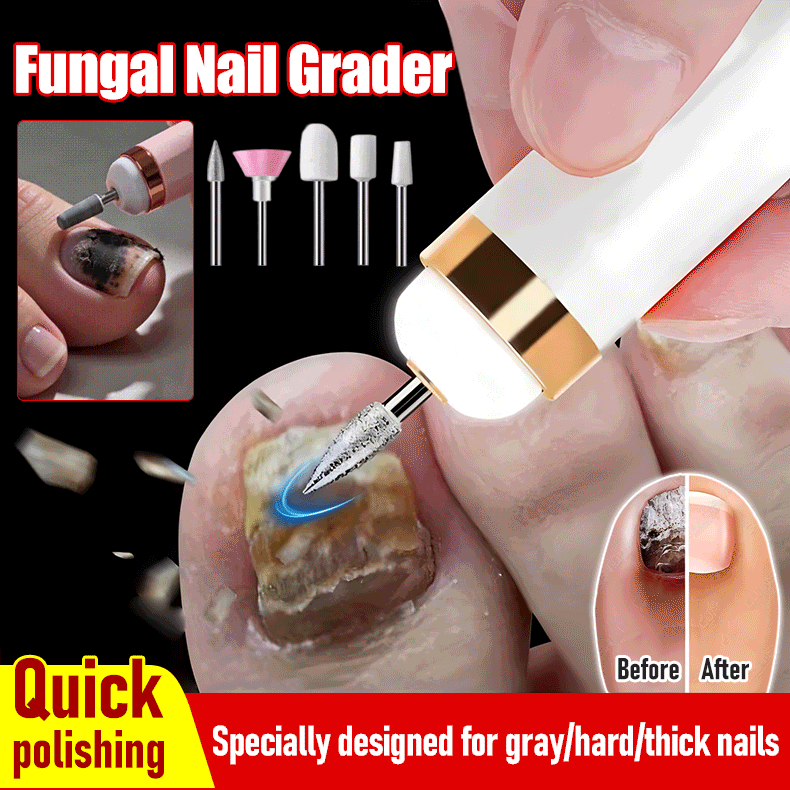🦶🦶 Electric nail file for onychomycosis, a small electric nail tool.
