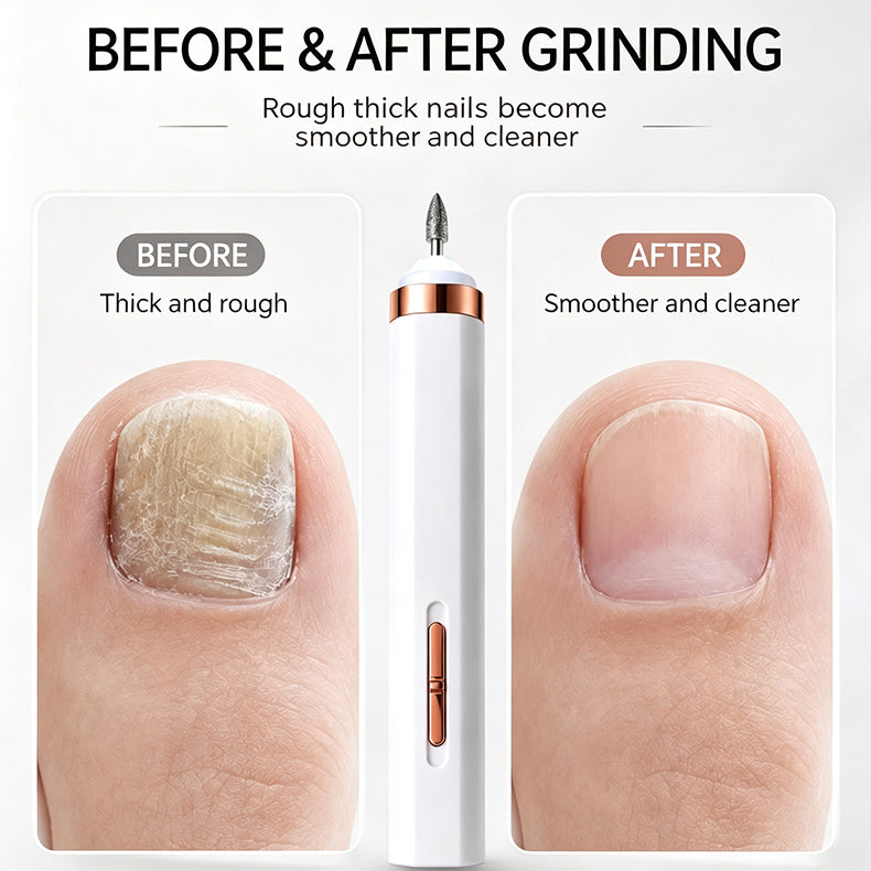 🦶🦶 Electric nail file for onychomycosis, a small electric nail tool.
