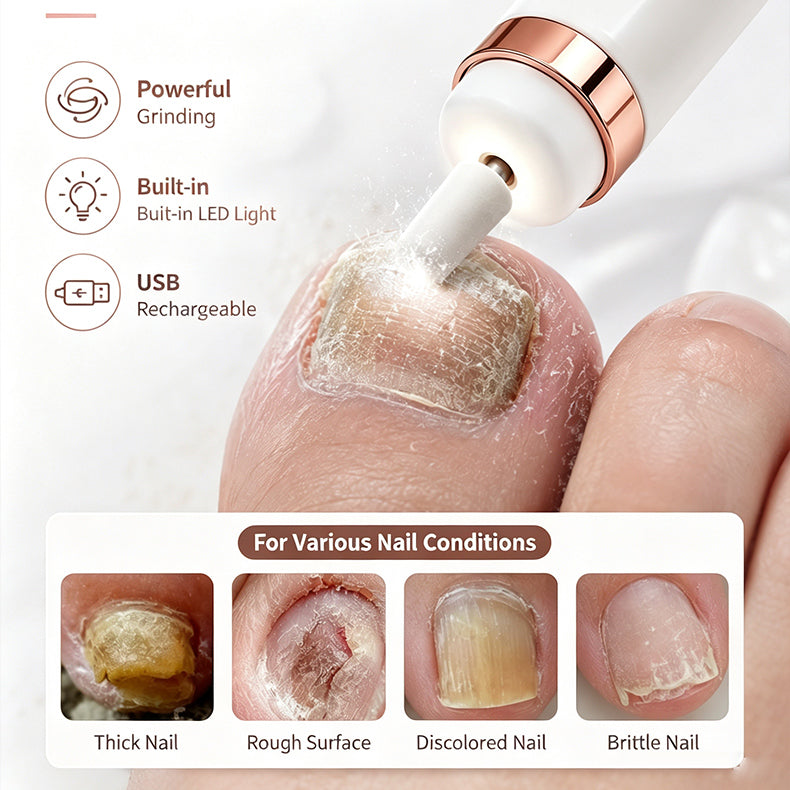 🦶🦶 Electric nail file for onychomycosis, a small electric nail tool.